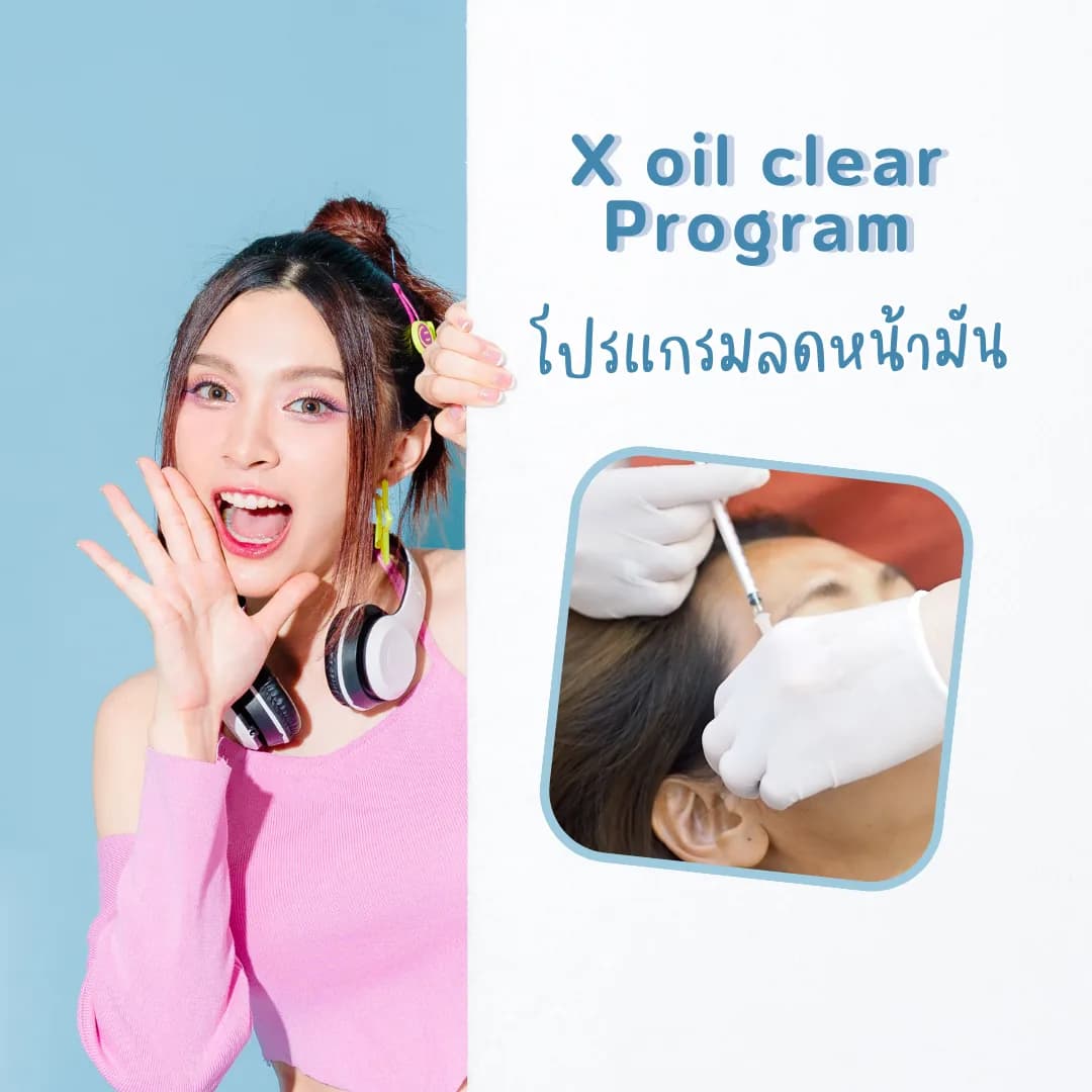 โปรแกรม X Oil Clear สำหรับปัญหาหน้ามัน: ข้อควรรู้ก่อนทำ