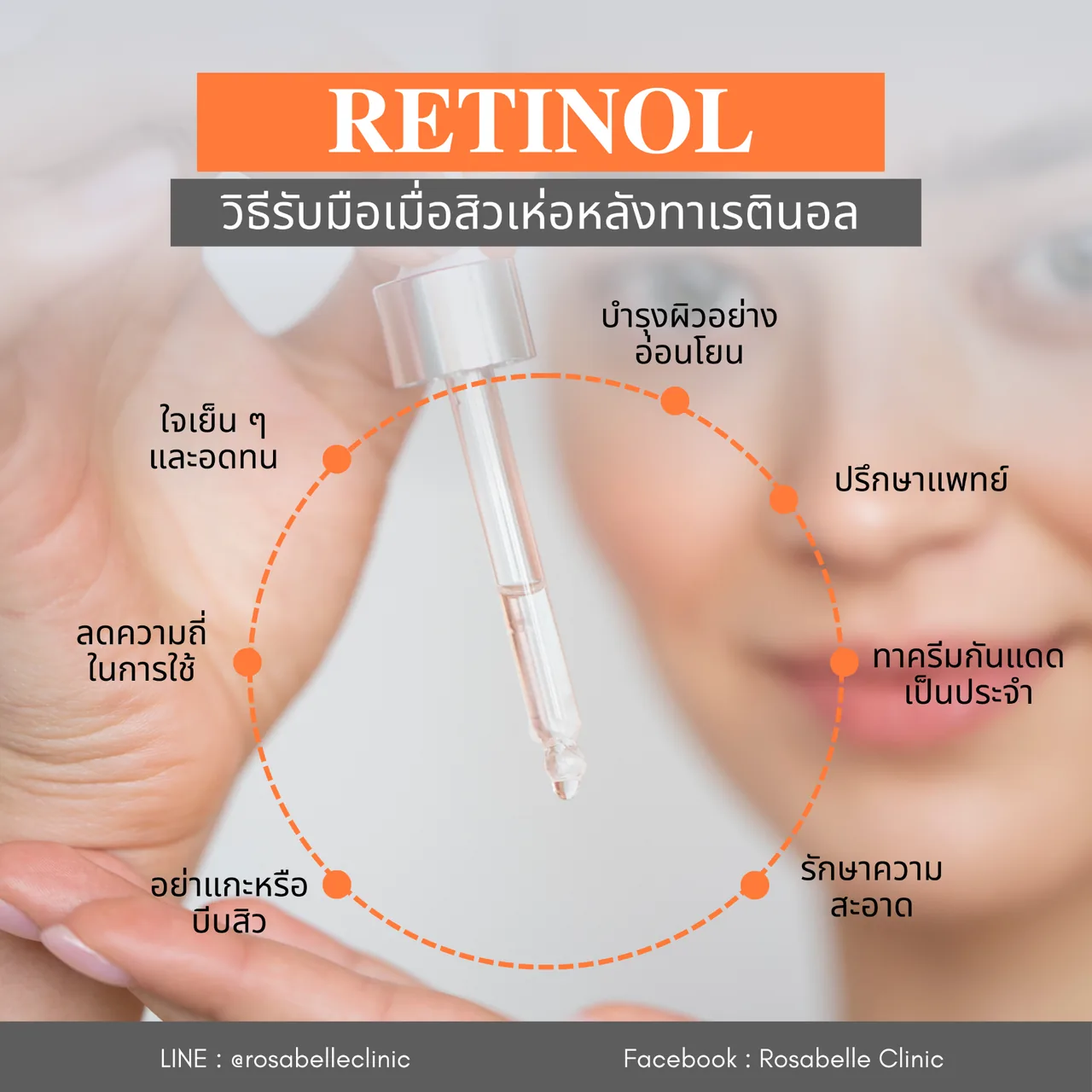ภาพประกอบวิธีรับมือเมื่อสิวเห่อหนักจากการทาเรตินอล Retinol ลำดับที่ 1