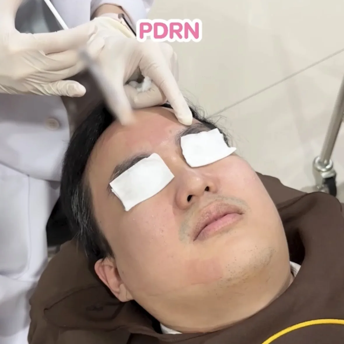 ภาพประกอบรีวิวโปรแกรม Combo Set รักษาหลุมสิว ที่ Rosabelle Clinic ลำดับที่ 17