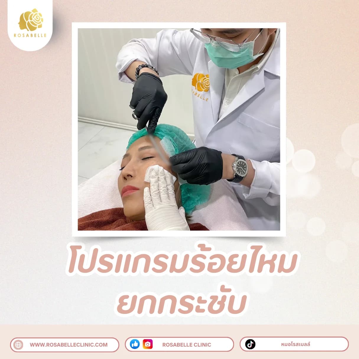 ภาพประกอบรวมโปรแกรมปรับรูปหน้าและยกกระชับ ที่ Rosabelle Clinic ลำดับที่ 3