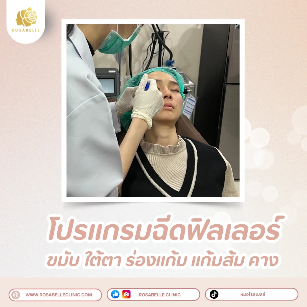 ภาพประกอบรวมโปรแกรมปรับรูปหน้าและยกกระชับ ที่ Rosabelle Clinic ลำดับที่ 4