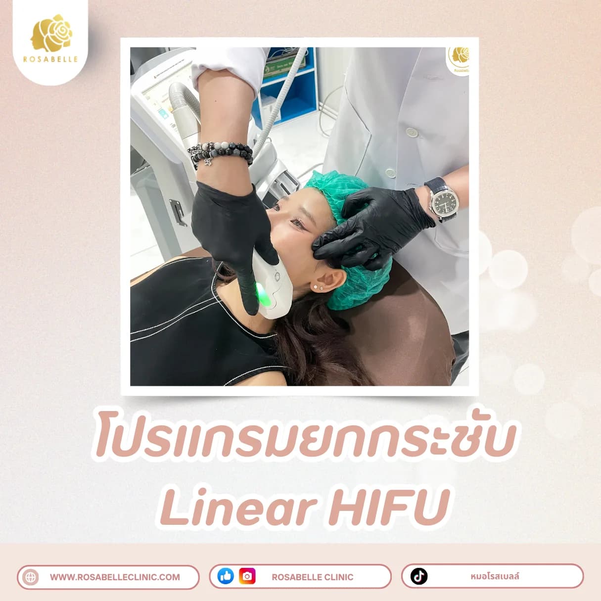 ภาพประกอบรวมโปรแกรมปรับรูปหน้าและยกกระชับ ที่ Rosabelle Clinic ลำดับที่ 5