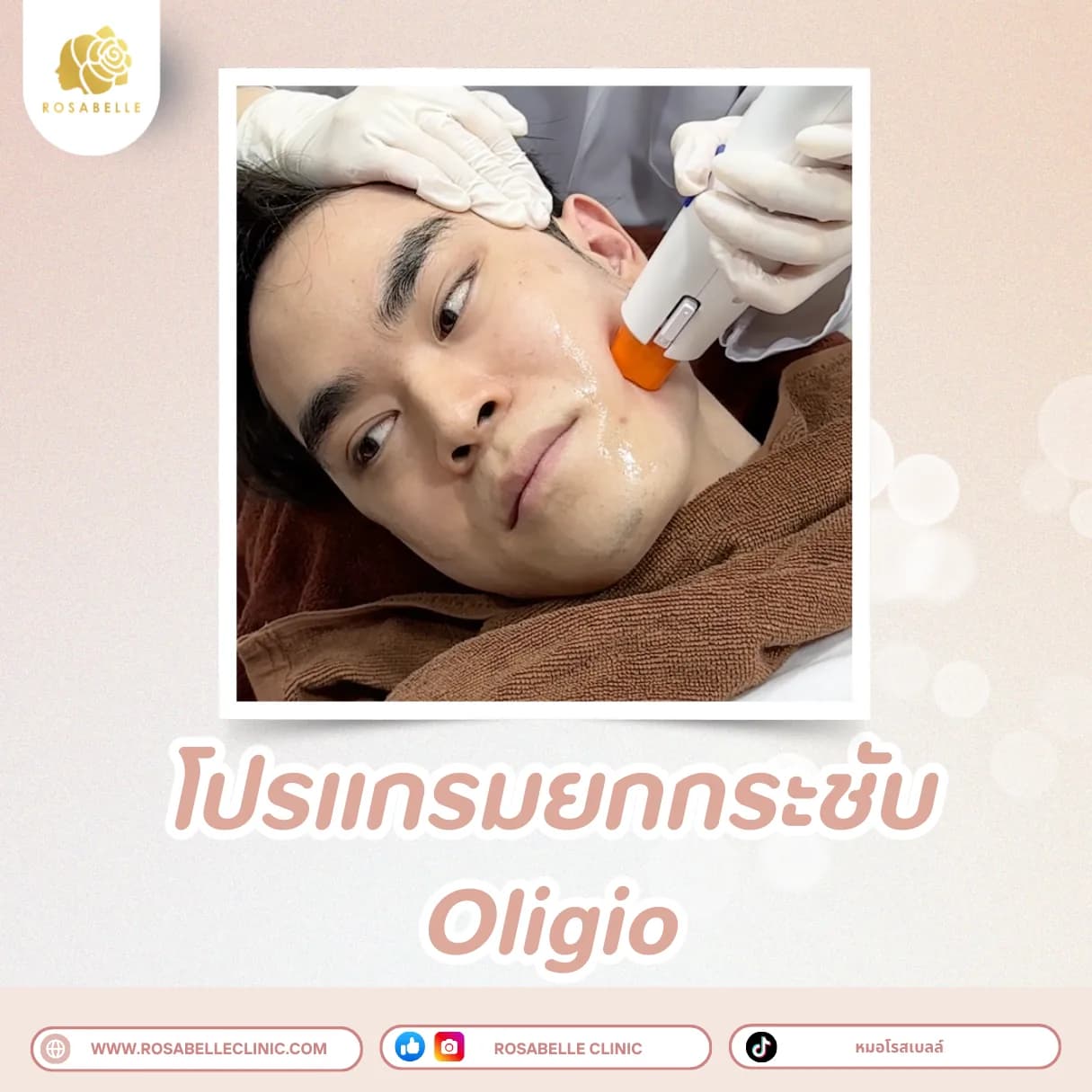 ภาพประกอบรวมโปรแกรมปรับรูปหน้าและยกกระชับ ที่ Rosabelle Clinic ลำดับที่ 6