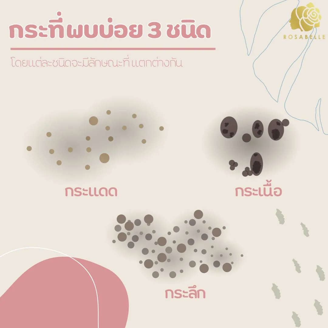 กระและจุดบนผิว: ควรประเมินอะไรก่อนรักษา