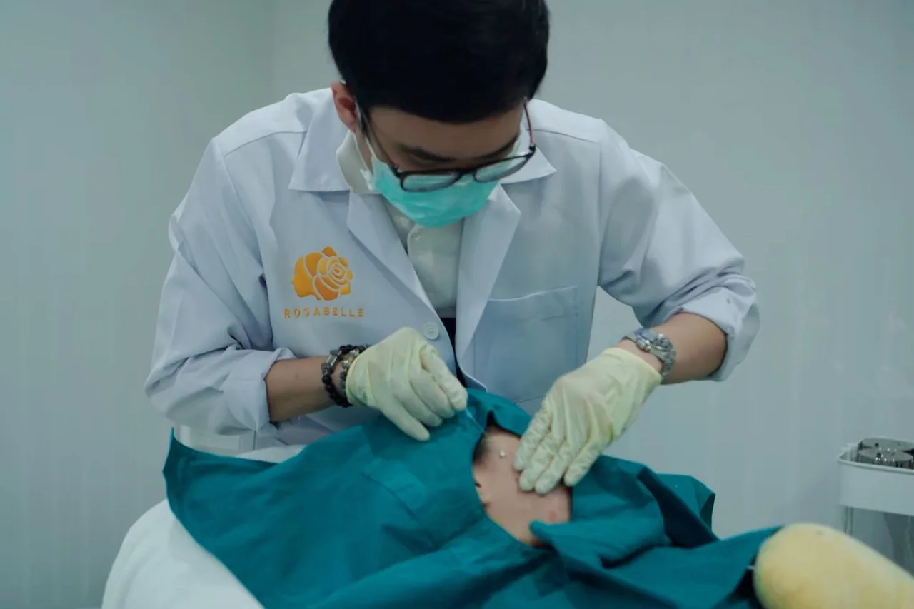 ร้อยไหมคืออะไร? ร้อยไหมหน้าเรียวที่ Rosabelle Clinic