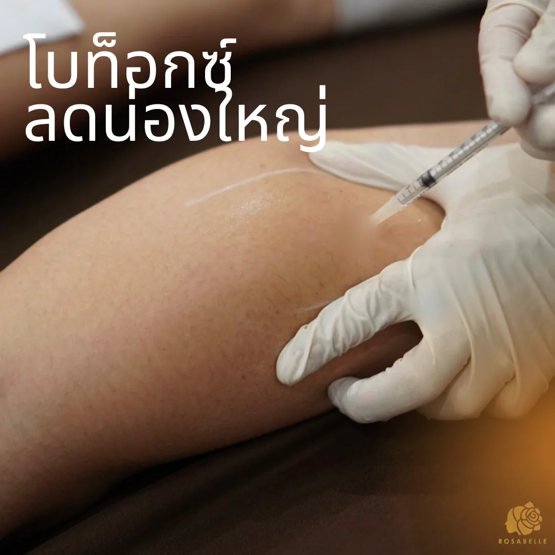 โปรแกรมโบทูลินุ่มท็อกซินบริเวณน่อง: ข้อควรรู้ก่อนตัดสินใจ