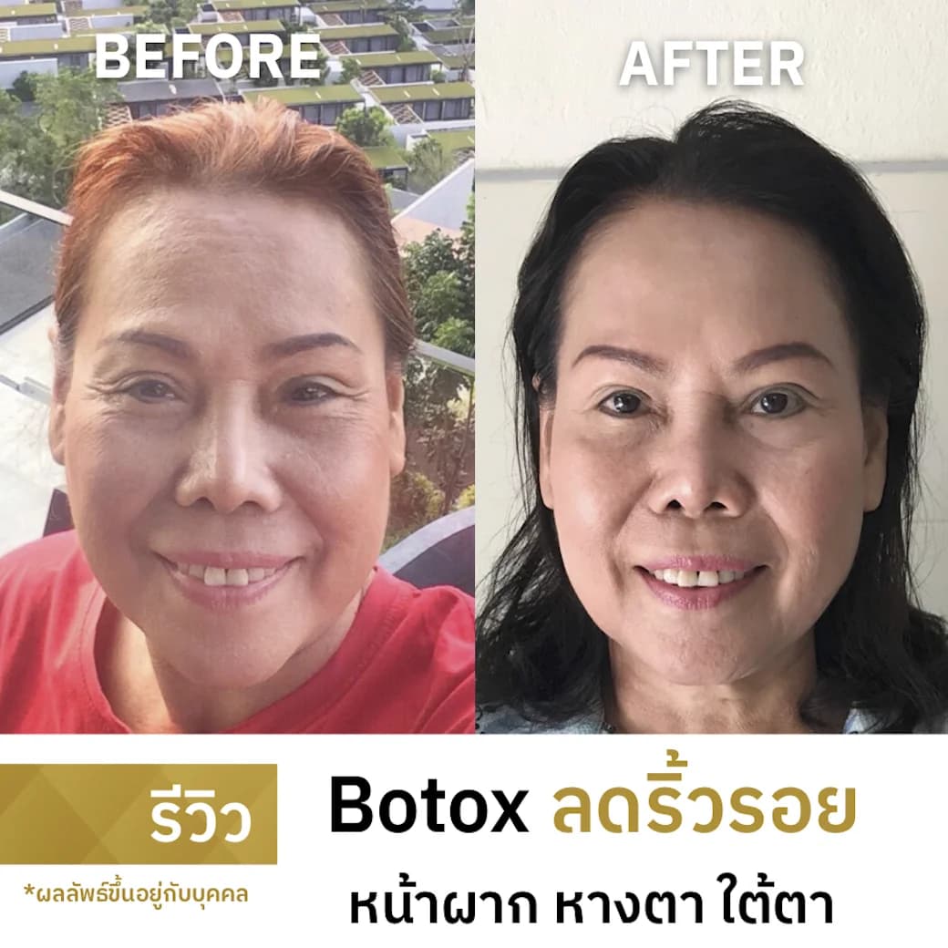 ภาพประกอบบทความ ไอเดียของขวัญวันแม่: เลือกดูแลผิวอย่างเหมาะสม