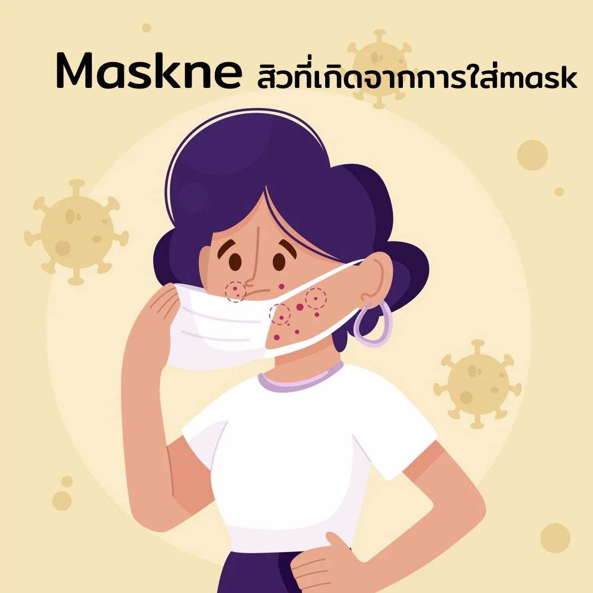 Maskne (Mask acne) สิวที่เกิดขึ้นที่สัมพันธ์กับการสวมใส่mask