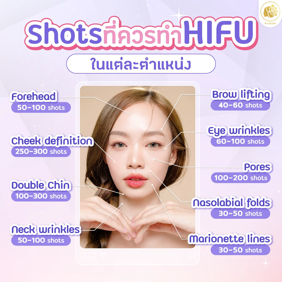 ภาพประกอบบทความ Linear HIFU program: skin lifting, risks and aftercare